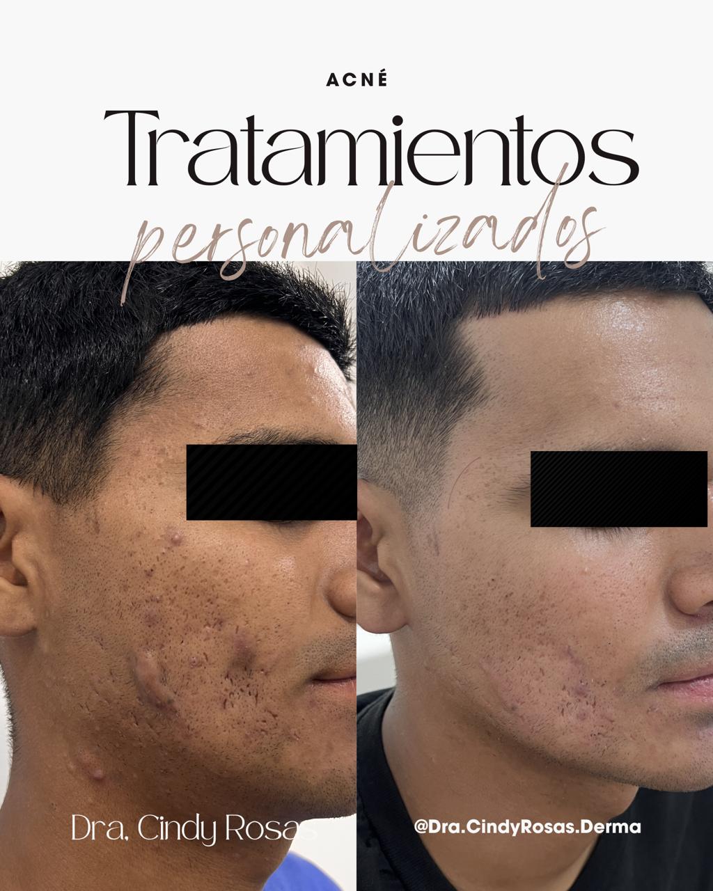 Equipamiento dermatológico moderno